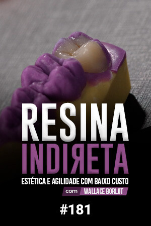 Resina Indireta. Estética e Agilidade com Baixo Custo