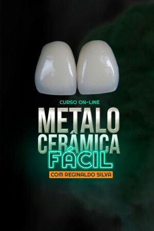 Metalocerâmica Fácil