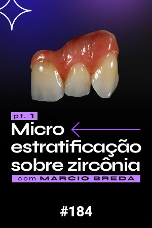 Micro Estratificação sobre Zircônia - PT1