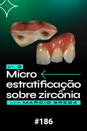 Micro Estratificação sobre Zircônia - PT2